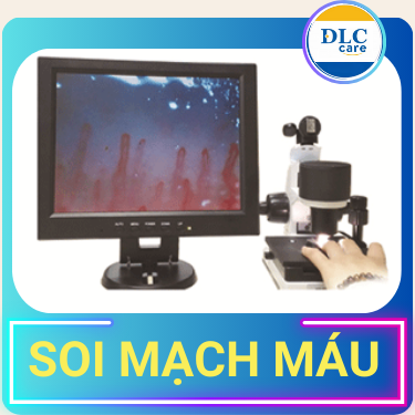 Máy soi mạch máu